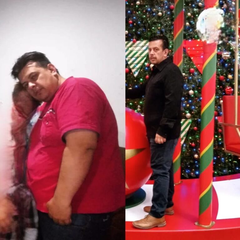 Mi transformación corriendo: Comparativa del antes y después de Juan Alexander Rodríguez al pasar de sobrepeso a runner.